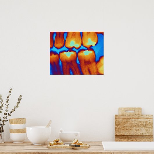 Tanden met vullingen (groen), gekleurde röntgenfot poster (Keuken)