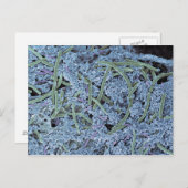 Tandheelkundige scanner, gekleurd briefkaart (Voorkant / Achterkant)