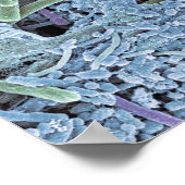 Tandheelkundige scanner, gekleurd poster (Hoek)