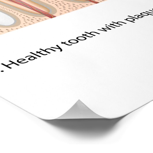 Tandverval Poster (Hoek)