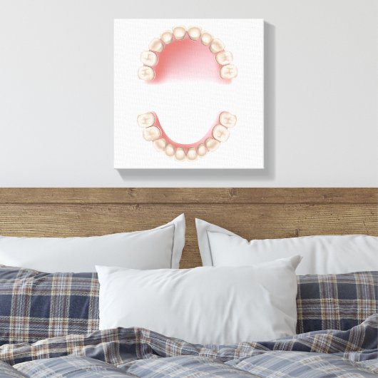 Tandvleesklier (baby) canvas afdruk (Insitu (Slaapkamer))