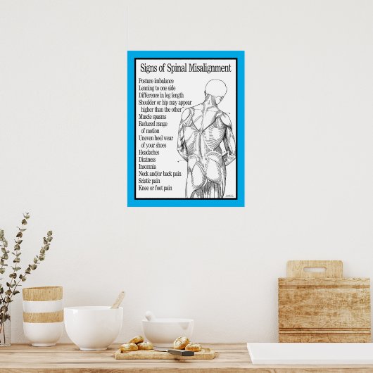 Tekenen van ruggenmerg Misgroepering Chiropractisc Poster (Keuken)