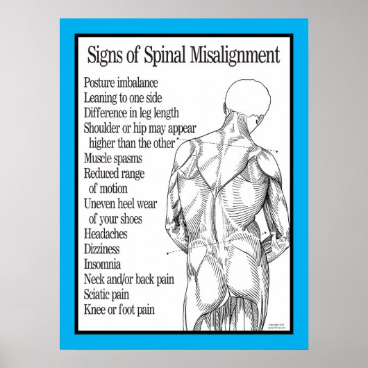 Tekenen van ruggenmerg Misgroepering Chiropractisc Poster (Voorkant)