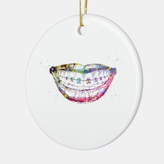 Testbeugels Keramisch Ornament (Links)