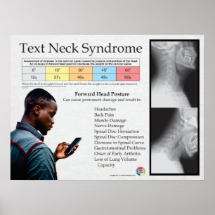 Text Neck Pain Syndrome Chart Poster