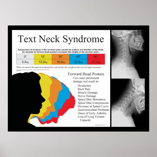 Text Neck Syndrome Chiropractic in Metric kg's Poster (Voorkant)
