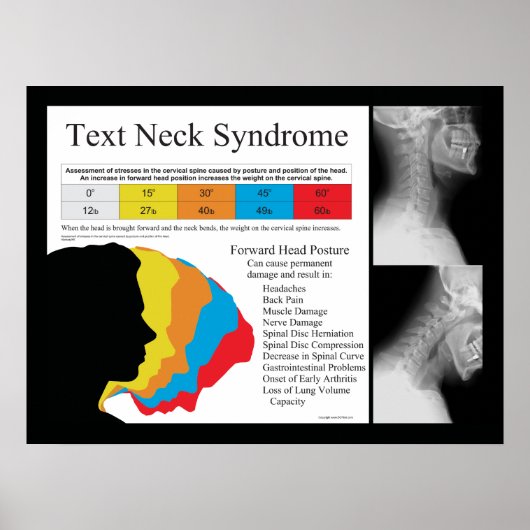 Text Neck Syndrome Chiropractic Poster (Voorkant)