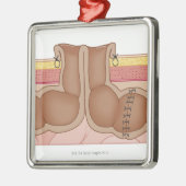 Tijdelijke kolostomie metalen ornament (Links)