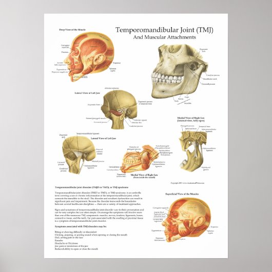 TMJ Anatomie Musculair Attachograaf Doctor Poster (Voorkant)