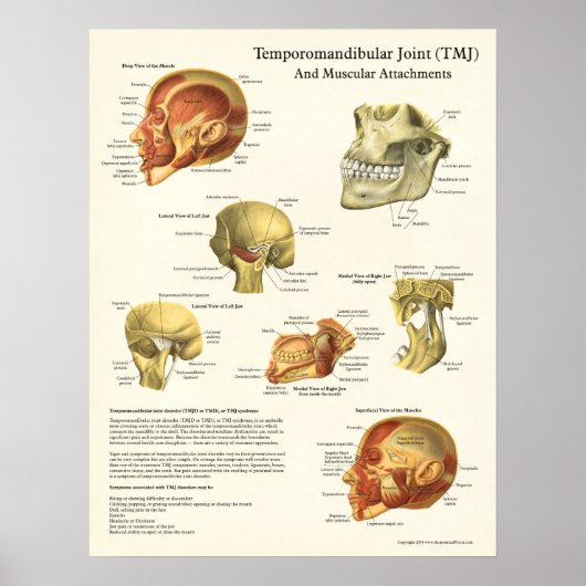 TMJ Poster voor anatomie en spierattachés (Voorkant)