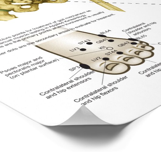 Toegepast Poster op kinsiologie (Hoek)