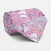 Tofakous Gout Pathology Stropdas (Opgerold)