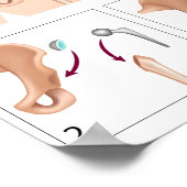 Totaal heupvervangende poster (Hoek)