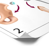 Totale druk voor heupvervangende operaties poster (Hoek)