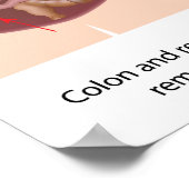 Totale proctocolectomie met poster van Brooke ileo (Hoek)