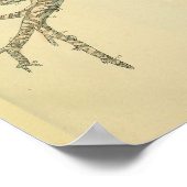 Trachea Airway Bronchi Eyes Anatomy Art Print (Hoek)