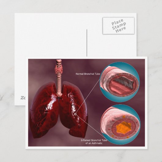 Trachea-doorsnede met longen briefkaart (Voorkant / Achterkant)