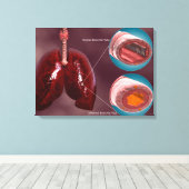 Trachea-doorsnede met longen canvas afdruk (Insitu (Houten vloer))