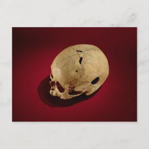 Trepaned Skull Briefkaart