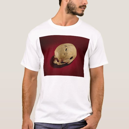 Trepaned Skull T-shirt (Voorkant)