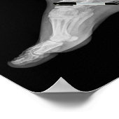 Trump Bone Spur Ink Pen Grappig Anti Trump Poster (Hoek)