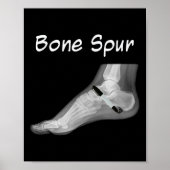 Trump Bone Spur Ink Pen Grappig Anti Trump Poster (Voorkant)