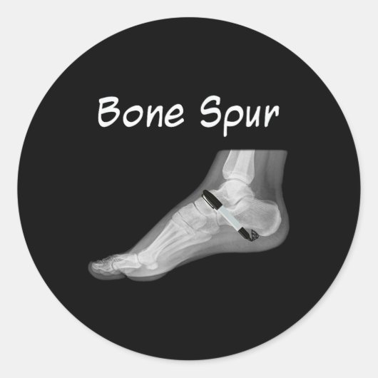 Trump Bone Spur Ink Pen Grappig Anti Trump Ronde Sticker (Voorkant)