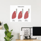 Tuberculose type Poster (Thuiskantoor)