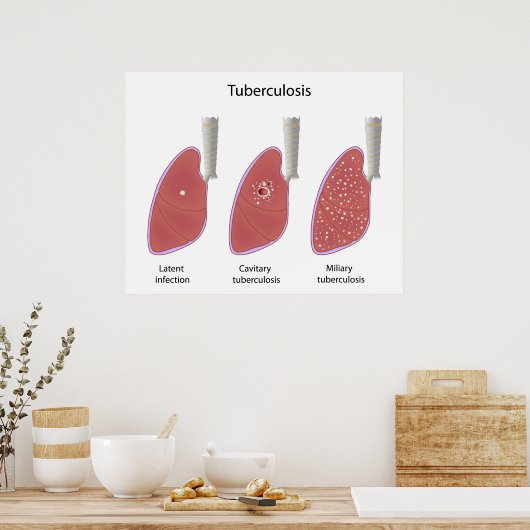 Tuberculose type Poster (Keuken)