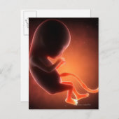 Twee maanden oude foetus briefkaart (Voorkant / Achterkant)