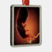 Twee maanden oude foetus metalen ornament (Rechts)