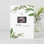 Twins Ultrasound Bedankt Baby-afvlakking (Staand voorkant)
