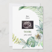 Twins Ultrasound Grapny Dank u wel Tropisch Bedankkaart (Voorkant)