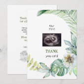 Twins Ultrasound Grapny Dank u wel Tropisch Bedankkaart (Voorkant / Achterkant)