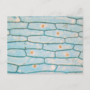 Ui onder de microscoop briefkaart