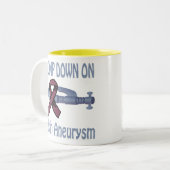 Uitsluiting op de Mok van het brein-Aneurysm (Voorkant links)