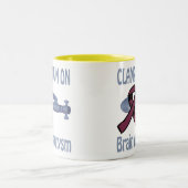 Uitsluiting op de Mok van het brein-Aneurysm (Center)