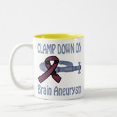 Uitsluiting op de Mok van het brein-Aneurysm (Links)