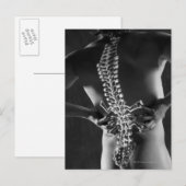 Uitzicht van het ruggenmerg briefkaart (Voorkant / Achterkant)