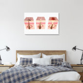 Uitzicht van wat acne veroorzaakt canvas afdruk (Insitu (Slaapkamer))