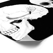 Uitzichten de schedel met de verwijderde CIs Poster (Hoek)