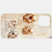 Uitzichten van een foetus in de baarmoeder, Ob-Gyn Case-Mate iPhone Case (Achterkant (horizontaal))