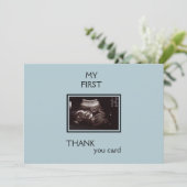 Ultrasone foto Dank u van het Punt van het Uitzich Bedankkaart (Staand voorkant)