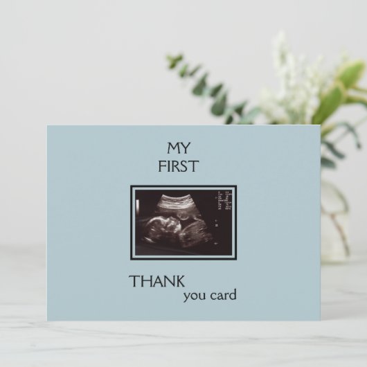 Ultrasone foto Dank u van het Punt van het Uitzich Bedankkaart (Staand voorkant)