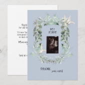 Ultrasone foto's Foliage Funny Hartelijk dank Baby Bedankkaart (Voorkant / Achterkant)