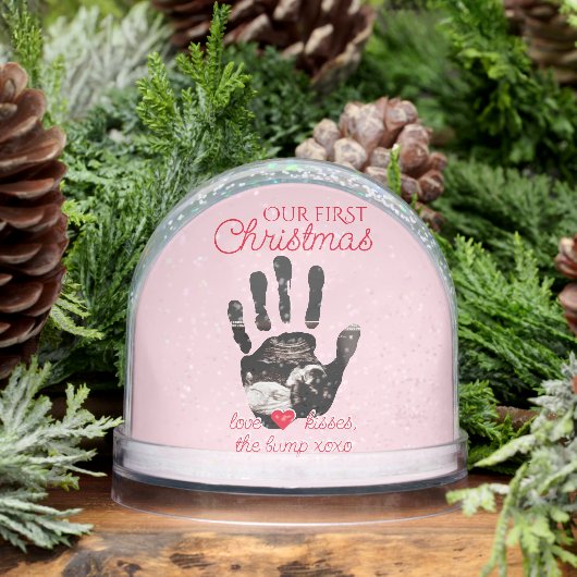 Ultrasound 1st Christmas Pregnancy Announcement Sneeuwbol (Winter)