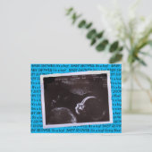 Ultrasound Afbeelding Baby shower Briefkaart (Staand voorkant)