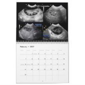 Ultrasound Afbeeldingen Agenda Kalender (Feb 2027)