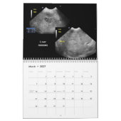 Ultrasound Afbeeldingen Agenda Kalender (Mar 2027)