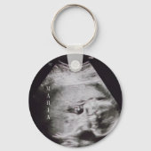 Ultrasound baby keepomwille sleutelhanger (Voorkant)